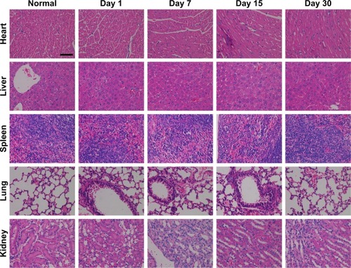 Figure 10 Studies of the long-term toxicity of the cascade amplified PTT treatment rendered by PL-UC-C3 plus a 980 nm laser through the H&E staining of heart, liver, spleen, lung, and kidney for 1, 7, 15, and 30 days after the treatment.Note: C3, organic compound; PL-UC-C3, encapsulation of UCNPs and C3 into PEG-PCL; PTT, photothermal therapy.Abbreviations: PEG, polyethylene-polyglycol; PCL, poly-e-caprolactone; UCNPs, up-conversion nanoparticles.