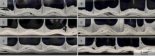 Figure 7. Cross-sections showing internal structure of tool-side facesheet and bond-line of autoclave-cured samples: A, baseline vacuum; B, vented bag; C, in-bag pressurization; D, in-bag pressurization with crushed core; E, long room-temperature vacuum hold; F, no intermediate dwell.