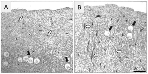 Figure 2. Cortical region of an ovary at an age of 23 (A) and 37 (B) years. Note blood vessels are scarce when young but increased its density with the increase of age (open arrows). Black arrows indicate resting oocytes. Bar represents 80 µm. (Delgado-Rosas et al. Citation2009).