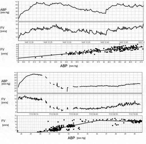 Figure 1. Relationship between TCD blood flow velocity and mean ABP in neonates. Upper panel: completely impaired autoregulation. Lower panel: intact autoregulation is suggested above the (lower) ABP threshold of 36 mmHg. From the material previously presented by Rhee et al J Perinat 2014; 34; 926–931. Abbreviations: ABP; arterial blood pressure, FV; flow velocity.