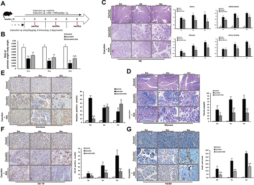 Figure 6 Aspirin attenuates caerulein-induced chronic pancreatic injury in C57BL/6 mice. (A) Schematic showing the experimental design of aspirin treatment of caerulein-induced CP in C57Bl/6 mice. (B) Ratio of pancreatic/body weight (n=6). (C) H&E staining in the pancreas of the CP models induced by caerulein (original magnification: 100×). Values of histological scoring were expressed as mean ± SD (n = 6). (D) Masson’s trichrome staining (original magnification: 100×), histograms showing the quantitative analysis of the % fibrotic area. (E) IHC staining for amylase in pancreas (original magnification: 400×) and morphometric analysis. (F) IHC staining for CK-19 in pancreas (original magnification: 400×) and morphometric analysis. (G) IHC staining for F4/80 in pancreas (original magnification: 400×) and morphometric analysis. **P<0.01 vs control group; ΔP<0.05, ΔΔP<0.01 vs CP group.