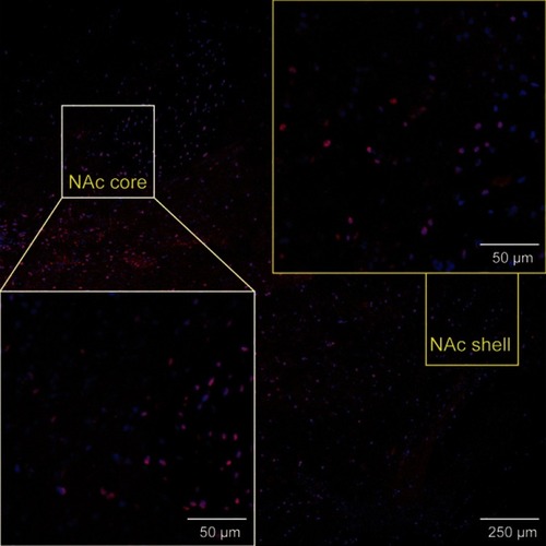 Figure S1 Images showing DR2 immunofluorescence in various ROIs in brain sections.