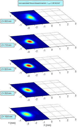 Figure 3. Transverse bundle shapes of the 10 channel, 2.4 MHz central frequency transducer at different depths. In these measurements, component phases are arranged as to obtain a focusing angle of 11 degrees. HIFU driver was drived at 2800 kHz with 10% amplitude. While it effects symmetrically, only the signal focused on left side is demonstrated.