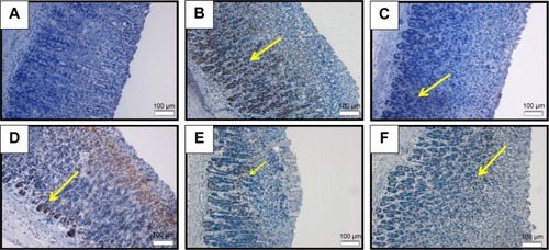 Figure 9 Bax IHC.