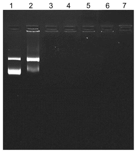 Figure 2 Gel retardation assay.Notes: One microgram of plasmid DNA was applied to the magnetoplex with mag- PEI nanoparticles at different N/P ratios. Lane 1 is the control DNA without mag-PEI nanoparticles. Lanes 2–7 represent mag-PEI NP/DNA magnetoplexes with N/P ratios of 0.4/1, 0.8/1, 1.6/1, 4.3/1, 8.7/1, and 17.5/1.Abbreviation: Mag-PEI, magnetic poly(methyl methacrylate) core/polyethyleneimine shell.