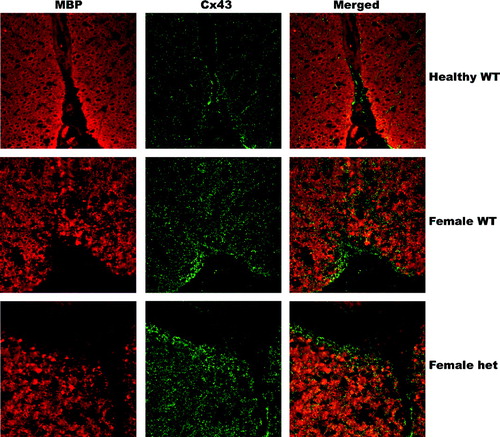 Figure 9 Heterozygous and wild-type mice have increased Cx43 in recovering lesions. Spinal cord tissue was labeled for Cx43 (green) and MBP (red) (630X). Both heterozygous and wild-type mice have increased Cx43 expression in recovering lesions compared with healthy controls. The heterozygous mice have increased Cx43 expression in remyelinating lesion areas that is qualitatively similar to the wild-type mice, even though the heterozygous mice only have one functioning Gja1+/− allele.
