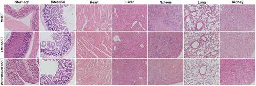 Figure 7. HE staining of normal tissues of stomach, small intestine, heart, liver, spleen, lung and kidney in different CAR-T treatment groups