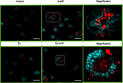 Figure 4 Representative CLSM images of intracellular AuNPs after 12 h of incubation in MCF-7 cells. AuNP uptake is enhanced by E2 and particles are taken closer to the cell nucleus. The fluorescence signal of AuNP (red) was observed around the cell nuclei that were stained with DAPI (cyan). Digitally zoomed images (10× magnification) are shown in right column to better illustrate the localization of AuNP. Scale bars are 20 μm.Abbreviations: AuNP, gold nanoparticle; CLSM, confocal laser scanning microscopy; DAPI, 4ʹ,6-diamidino-2-phenylindole.