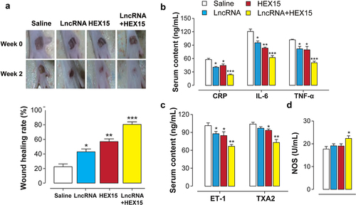 Figure 5. Combination therapy of HEX15 and LncRNA in DFU rats. The changes of (a) wound healing rate, (b) pro-inflammatory factors and (c-d) vascular regulator after 2-week combined treatment of HEX15 and lncRNA in DFU rats. All data are expressed as means with error bars as standard deviations (n = 8). *, ** or *** denote P < 0.05, 0.01 or 0.001 vs. saline treated group.
