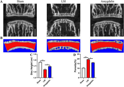 Figure 3 AMD mitigated intervertebral disc degeneration in LSI mice. (A) Representative micro-CT images of a midsagittal plane at L4-L5. (B) Representative 3D-reconstruction images of L4-L5 endplate with the coronal plane. The red area indicated IVD space. (C) Quantitative analysis of disc height at L4–L5. (D) Quantitative analysis of the endplate porosity at L4–L5. Data were presented as means ± S.D. *P < 0.05; **P < 0.01, n = 6 in each group.