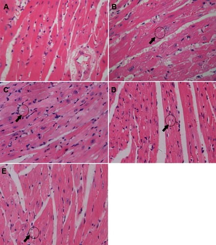 Figure 5 Res-SLN protects myocardium from doxorubicin-induced cardiotoxicity. Myocardial tissue biopsy (200X) of mice in control group (A), model group (B), Res group (C), Res-SLN group (D), and Digoxin group (E) (the vacuoles were indicated by black arrows and circles).Abbreviations: Res, resveratrol; SLN, solid lipid nanoparticles.