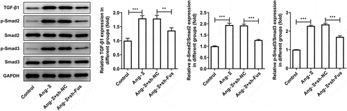 Figure 3. Fus knockdown inhibits AngII-induced TGF-β1/Smad pathway activation. Mouse cardiac fibroblasts that silenced with Fus or not were stimulated with 1 μM AngII for 12 h, then the protein expression of TGF-β1, phosphorylated (p)-Smad2/Smad2 and p-Smad3/Smad3 was assessed by western blot. **P < 0.01 and ***P < 0.001