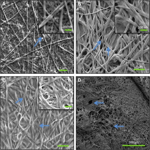 Figure 1 SEM photographs showing the morphologies of NMC, TMC, and BMC scaffolds.Notes: (A) NMC scaffold at high magnification; the arrow shows collagen fibrils without mineralization. (B) TMC scaffold at high magnification; the arrows show collagen fibrils mineralized by SBF after 24 hours. (C) BMC scaffold at high magnification; the arrows show collagen fibrils mineralized by CMC/ACP after 24 hours. (D) BMC scaffold at low magnification; the arrows show porous microstructures of BMC scaffold. The upper right illustrations represent local amplification of each photograph, respectively.Abbreviations: ACP, amorphous calcium phosphate; CMC, carboxymethyl chitosan; SBF, simulated body fluid; SEM, scanning electron microscopy; BMC, biomimetic mineralized collagen; NMC, non-mineralized collagen; TMC, traditional mineralized collagen.