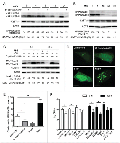 Figure 2. Autophagy is inhibited in response to B. pseudomallei infection. (A and B) B. pseudomallei decreased the conversion of MAP1LC3B-I to MAP1LC3B-II in A549 cells. A549 cells were treated with B. pseudomallei (MOI = 10:1) for 2, 4, 6, 12 and 24 h, or at MOI = 0, 1, 10, 50, and 100 for 6 h. (C) A549 cells were treated with B. pseudomallei (MOI = 10:1) for 6 h and 12 h in the presence of CQ (10 μM). (D and E) Confocal images show GFP-MAP1LC3B distribution in A549 cells infected with B. pseudomallei for 6 h, and uninfected cells treated with 3-MA (10 mM) or Rapa (200 nM). Scale bars: 5 μm. The number of GFP-MAP1LC3B puncta in each cell was counted. (F) Stimulation of autophagy suppresses intracellular survival of B. pseudomallei in A549 cells. After pretreatment by DMSO, Rapa and 3-MA, or transfected with ATG12 siRNA (100 nM), A549 cells were infected with B. pseudomallei (MOI = 10:1) for 6 h and 12 h. The bar represents the mean ±SD of 3 experiments. *, P<0.05, **, P<0.01.
