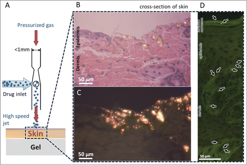 Figure 5. Delivery of pDNA-coated gold particles into the ex vivo skin models. (A) Schematic diagram of a single nozzle of a device operating to deliver pDNA-coated gold particles into the freshly excised skin placed over a gel as a soft substrate. Schematic is not to scale. (B) Histology of mouse skin tissue by hematoxylin and eosin (H&E) staining after ejected with gold particles, visualized by bright field microscopy. (C) Dark field microscopy of histology sample in B reveals the glowing gold particles penetrated into the skin. (D) Histology of pig skin tissue by H&E staining after bombardment visualized by dark field microscopy.