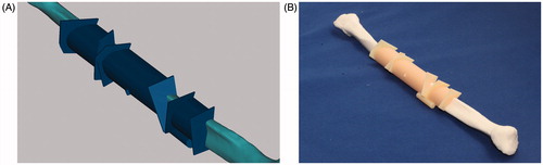 Figure 3. Fibula cutting guide template. (A) The fibula cutting guide template was prepared, based on the computer-aided design of a mandibular reconstruction with the fibula. The template (dark blue) includes sleeves that wrap around the fibula, and small sheets (upright squares) that indicate the cutting angles. (B) The fibula cutting guide template was fixed to the intact fibula (RP model). The cutting guide template was prepared with a 3D printer and biomaterials.
