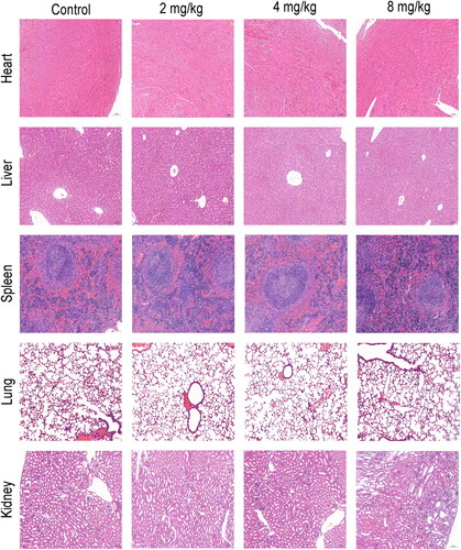 Figure 9. Mice with tumours were treated with SAG, and heart, liver, spleen, lung, and kidney tissue were stained with haematoxylin-eosin (HE). In both groups, there were no significant abnormalities in HE staining, and there was no difference between the treatment and control groups.