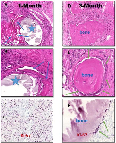 Figure 8. Histopathology of in vivo effects of β-tricalcium-phosphate-aerogel (β-TCP-AE) compound for scaffolding and in turn ossification to restore the 8 mm cylindrical bone defects in rat’s calvarial skull bones 1 month (left panel) and 3 month after the surgical substitutionary interventions (right panel). Representative images are shown obtained from formalin-fixed paraffin-embedded decalcified tissue sections stained with hematoxylin-eosin (A–B and D–E), and immunohistochemistry for Ki-67 (C and F), respectively. Following one month of bone defect replaced with β-TCP-AE, there is a rapid injury- and foreign material-induced inflammation with granulation tissue formation that tends to fibrose and calcify with early ossification (A-B, blue arrows) around the exogenous compound (asterisks). C, Dense nuclear positivities (dark purple dots) among inflammatory and mesenchymal cells highlight leukocyte, fibroblasts and osteoblasts in active cell-cycle. D-E, Following a three-month duration of cylindrical bone defect replacement with β-TCP-AE, the hole became filled by islets of well-developed solid bone tissues embedded in moderately matured (less cellular) connective tissue with significantly decreased active inflammatory cells. F, However, based on Ki-67 immunohistochemistry, the bone-associated osteoblasts (green arrows) remain in active cell cycle (dark purple dots) indicating progressive ossification inside the defect. Original magnifications: A and D, 10x; B, 20x; E, 40x; C and F, 20x. For immunohistochemical images, a methyl-green nuclear counter-staining were used (C and F).