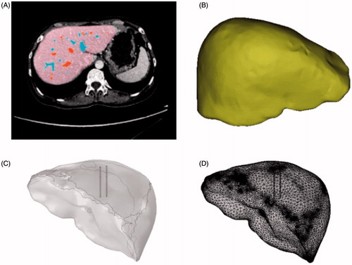 Figure 3. 3D liver models, (A) processed CT images, (B) optimized liver model, (C) geometric model, (D) mesh model.