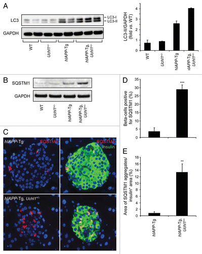 Figure 6. UCHL1 deficiency exacerbates defects in lysosomal degradation in hIAPP-Tg mouse islets. Protein levels of LC3 (A) and SQSTM1 (B) were assessed by western blotting using islet protein lysates obtained from 7–8-wk-old WT (n = 2), Uchl1+/− (n = 2), hIAPP-Tg (n = 2) and hIAPP-Tg, Uchl1+/− mice (n = 3). GAPDH was used as a control. The graph represents the quantification of LC3-II protein levels. (C) SQSTM1 protein levels were assessed by immunofluorescence (SQSTM1, red; insulin, green; nuclei, blue) in pancreatic tissue from 7–8-wk-old hIAPP-Tg mice and hIAPP-Tg, Uchl1+/− mice. (D) The graph represents the quantification of β-cells positive for SQSTM1 in each group (expressed in %). (E) The graph represents the quantification of β-cell area positive for SQSTM1 aggregates in each group (expressed in %). Data are expressed as mean ± SEM; **P < 0.01; ***P < 0.001, significant differences vs. hIAPP-Tg mice.
