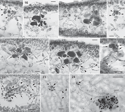 Figs. 15–24. Judithia delicatissima carpogonial branch/auxiliary cell systems and carposporophyte development. Fig. 15. Carpogonial branch system consisting of supporting cell (sc) bearing 3-celled carpogonial branch (cb) and three subsidiary cells (arrowheads). Fig. 16. Carpogonial branch system after fertilization with long trichogyne (tri) borne on carpogonial branch (cb). Note enlarged and stained darkly supporting cell (sc) and subsidiary cells (sub). Fig. 17. Early post-fertilization showing enlarged cells in carpogonial branch system in relation to smaller sized, nearby auxiliary cell system (aux). Note two minute cells (arrows), functioning as connecting cells, produced from two subsidiary cells but no cells cut off from supporting cell (sc). Fig. 18. Auxiliary cell system (aux), arrowheads indicate subsidiary cells. Fig. 19. Early post-fertilization stage with numerous connecting cells (black arrows) cut off from subsidiary cells. Note some connecting cells with pit connections to vegetative filaments (white arrows) produced from subcortical cell (arrowhead). Fig. 20. Later stage showing more connecting filaments (white arrows) produced from presumed diploidized subcortical cells and their derivatives (arrowheads) near carpogonial branch system. Note more connecting cells (black arrows) cut off from subsidiary cells. Fig. 21. Auxiliary cell system with one subsidiary cell (white arrowhead) receiving diploid nuclei via filament (white arrow) produced by nearby diploidized vegetative cell (black arrowhead). Fig. 22. Cross-section through young cystocarp showing young gonimoblast filaments (black arrows) produced from modified vegetative cells (black arrowheads) near auxiliary cell system. Fig. 23. Subsurface view of post-fertilization stage similar to Fig. 17 showing enlarged subsidiary cell in the carpogonial branch system (black arrow), darkly stained, modified subcortical cells (black arrowheads) nearby and connecting filament (white arrow). Fig. 24. Subsurface view of later stage showing young gonimoblast filaments (gon), remaining carpogonial branch system (black arrow), and connecting filaments (white arrows) produced from modified subcortical cell (black arrowhead). Figs 15–22: haematoxylin stain mounted in 50% Hoyer’s mounting medium; Figs 23–24: haematoxylin stain mounted in Piccolyte. Figs 15–22 (WELT A033083); Figs 23–24 (WELT A024374A).Scale bars: Figs 15,18 = 10 µm; Figs 16, 17, 19–23 = 20 µm; Fig. 24 = 50 µm.