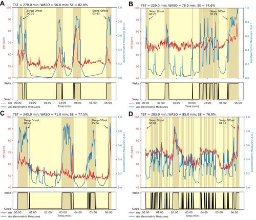 Figure 1 Minute-by-minute smartbands measures for each AHI’s severity class. Accelerometric, heart rate (HR) measures and sleep-wake classification according to the DORMI algorithm for (A) Healthy participant (AHI = 0.0/h), (B) Mild (AHI = 12.1/h), (C) Moderate (AHI = 16.8/h), and (D) Severe (AHI = 60.1/h) representative OSAS patients.