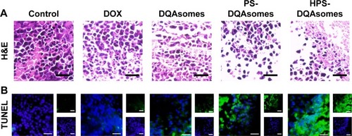 Figure 9 Ex vivo histological evaluation of tumor tissue.Notes: (A) H&E staining assay of different formulations treated groups. Blue and pink pixel dots represent nuclei and cytoplasm, respectively. (B) TUNEL assay of different formulations treated groups. Blue fluorescence and green fluorescence indicate nucleic and apoptosis cells, respectively. Scale bar represents 50 μm.Abbreviations: DOX, doxorubicin; DQA, dequalinium; HPS, HER-2 peptide-PEG2000-Schiff base.