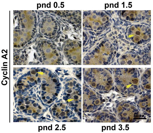 Figure 1. Cyclin A2 protein is expressed in mouse gonocytes. Immunohistochemistry with anti-cyclin A2 antibodies at pnd 0.5, pnd 1.5, pnd 2.5, and pnd 3.5 testes showed that gonocytes express cyclin A2 from pnd 1.5 but not at pnd 0.5; the yellow arrowheads in pnd 1.5, 2.5, and 3.5 indicate cyclin A2 positive gonocytes. Bar indicates 50 μm.