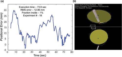 Figure 3. (a) Positional error as a function of time for completion of experiment 18, including the total time, RMS error, and fraction of distance measurements taken inside the tumor. (b) The corresponding surgical path traced out by one volunteer in this experiment. [Color version available online.]