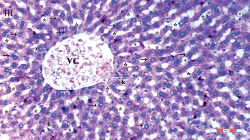 Figure 4. Light microscopic view of liver tissue of group IR-Sevo (HL: hepatic lobules; VC: vena centralis; *: sinusoid dilatation; ↓↓: infiltration; →: hepatocyte; k: kupffer cell hyperplasia; (*): necrotic and apoptotic appearance in hepatocytes), H&EX100.