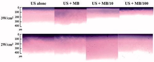 Figure 3. Microscopy images of agarose phantoms after 2-W/cm2 or 3-W/cm2 US combined with MBs (2.9 × 109/ml), 10-fold-diluted MBs (2.9 × 108/ml) and 100-fold-diluted MBs (2.9 × 107/ml) (n = 4).