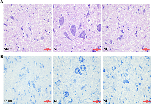 Figure 4 The KOR agonist down-regulated neuropeptide CGRP and ameliorated neuronal injury. (A) HE staining (scale bar = 50µm); (B) Nissl staining (scale bar = 50µm).