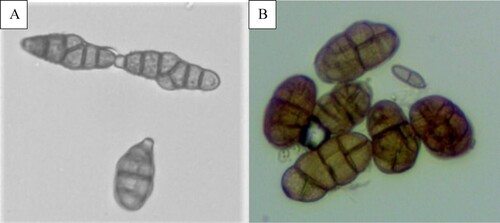 Figure 3. Conidia of (A) Alternaria sp. and (B) Stemphylium sp. (magnification × 40).