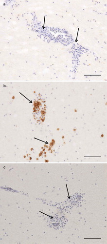 Figure 3. Photomicrographs of IHC to identify T and B cells, bar = 100 µm. Arrows = perivascular lymphoplasmacytic infiltrates. Cerebrum, negative control (a). Cerebrum, CD3-staining, numerous strongly positive (brown) cells (b). Cerebrum, CD79-staining, no positive cells (c).