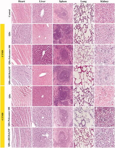 Figure 8. Toxicity analysis via pathological HE staining of organs from C6 rats after treatment with different QD formulations. Original magnification: ×200. The scale bar represents 100 μm.