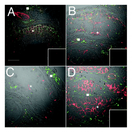 Figure 4. JAM-A localization is disorganized in carcinoma in situ and becomes highly expressed in malignant seminoma. Confocal immunofluorescence of normal human testis (A), carcinoma in situ (B and C) and seminoma sections (D) detecting JAM-A (red, asterisks) and connexin 43 (green, gap junctions, squares). Inserts are negative controls. (Bar = 50 µm).