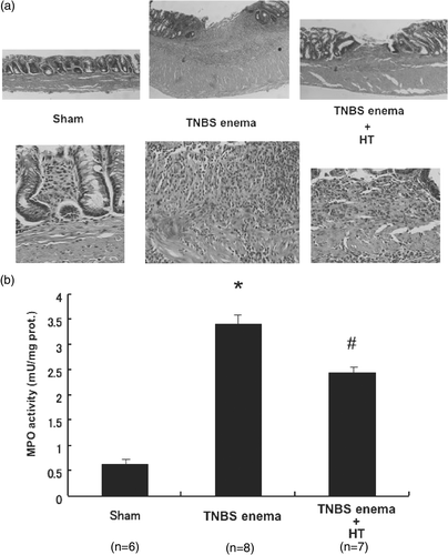 Figure 4. Histological changes, tissue MPO activities in the colon after TNBS treatment. (a) Microscopic findings of colonic mucosa in TNBS-induced rat colitis. (b) Effect of HT on the increase of neutrophil accumulation in colonic mucosa 6 days after the enema of TNBS. Values are the means ±SEM of 6–8 mice. *p < 0.001 vs. sham, #p < 0.05 vs. TNBS enema.