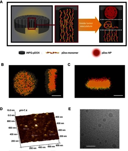 Figure 4 iNPG-pDox characterization and pDox (polymeric drug) assembly and release from iNPG (injectable nanoparticle generator).Notes: (A) Schematic diagram depicting iNPG-pDox composition, pDox prodrug encapsulation, and pDox nanoparticle assembly and release from nanopores. (B) Z-series confocal microscopy imaging of the iNPG-pDox particles, highlighting the presence of pDox (red) within the nanopores of the silicon carrier particle (gray). Scale bar, 1 µm. (C) Three dimensional reconstruction following sagittal cross-sectioning of the iNPG-pDox particles, depicting pDox (red) within the nanopores of the silicon carrier particle (gray), as well as the presence of pDox nanoparticles (red) released from the microparticles. Scale bar, 1 µm. (D) AFM analysis of size distribution of pDox nanoparticles released from iNPG-pDox at pH 7.4. (E) Cryogenic TEM of pDox nanoparticles released from iNPG-pDox at pH 7.4. Scale bar, 150 nm. Reprinted by permission from Springer Nature: Nature, Nature Biotechnology (https://www.nature.com/nbt/), Xu R, Zhang G, Mai J, et al. An injectable nanoparticle generator enhances delivery of cancer therapeutics. Nat Biotechnol. 2016;34(4):414–418, Copyright © 2016.Citation32