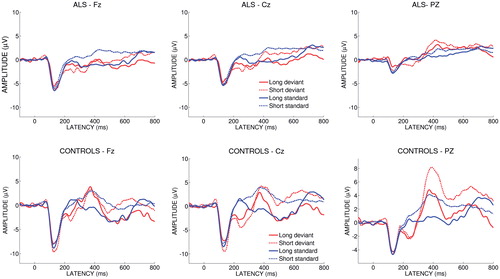 Figure 1. The figure shows the grand average ERPs recorded in response to short deviant, long deviant, short standard and long standard tones of ALS patients and controls at Fz, Cz and Pz.