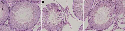 Figure 1. Morphology of the seminiferous tubules. HE staining, ×400. in the control group, the Sertoli cells were located at the base of the seminiferous tubules (A). In the Cd group, the seminiferous epithelium in the seminiferous tubules became thinner and disorderly arranged, and the gaps between the cells widened (B). In the Cd&AsIV group, the seminiferous epithelium had more regular arrangement in the seminiferous tubules, vacuolation was reduced in the cytoplasm of sertoli cells, and some spermatogenetic cells were sloughed off (C)