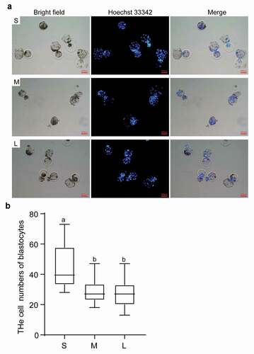 Figure 7. Effects of different sized PFFs on the blastocyst formation. A. The blastocysts derived from different sized PFFs for SCNT. Scale bar = 200 μm. B. The cell numbers of blastocysts. Data are presented as mean±SD of three independent experiments (a, b, cP<0.05)