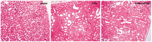 Figure 1. Light microscopic examination of the kidneys. (A) shows the kidney of sham-operated group. There is a mild to moderate glomerular congestion, and severe tubular dilatation and injury in ESW group (B). Tubular structures are seen preserved in the kidneys of ESW + OT groups (C) compared with the ESW group.