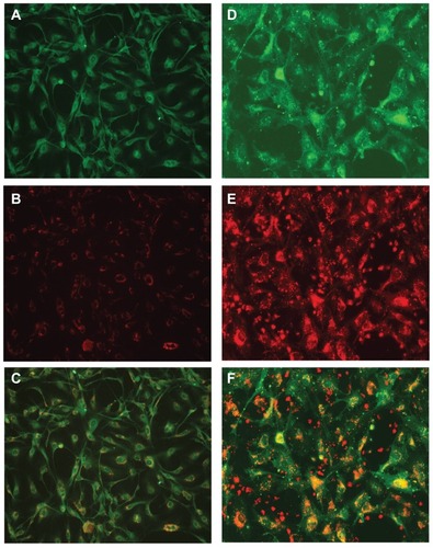 Figure 2 Uptake of nanoformulated crystalline antiretroviral drugs (nanoART) by human brain microvascular endothelial cells (HBMEC) following endothelial-mononuclear phagocyte cocultivation. (A–C) Primary HBMEC were exposed for 2 hours to conditioned media from monocyte-derived macrophages (MDM) loaded with rhodamine-labeled efavirenz (P4004) as described in the Methods section; HBMEC were then washed three times with phosphate buffered saline to remove MDM-conditioned media, and analyzed by fluorescence microscopy. Panels (B and C) show endothelial cells uptake of nanoART (orange-yellow color) released by MDM. Staining with the endothelium-specific marker, von Willebrand factor (green, A) confirmed the endothelial nature of our primary HBMEC. (D–F) Primary HBMEC labeled with DiO (green, D) were cocultured for 2 hours with monocytes loaded with rhodamine-labeled ritonavir (H2013), washed to remove monocytes, and analyzed by fluorescence microscopy. Panels (E and F) show endothelial cells uptake of nanoART (orange-yellow color) during endothelial-monocyte cocultivation.Note: All panels are at 200× magnification.