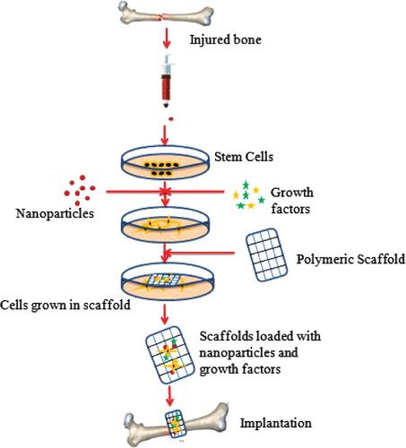Figure 6. Steps involved in bone tissue engineering. Mesenchymal cells are isolated from the donor patient and differentiated into osteoblasts in vitro before loading onto engineered scaffolds consisting of polymers, biomaterials, growth factors, etc. The scaffolds are then implanted onto the bone to initiate bone repair and regeneration (Figure has been recreated from [Citation76]).