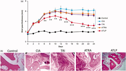 Figure 5. In vivo anti-arthritic efficacy of TRI, ATRA and ATLP in terms of hind paw thickness. The formulations were administered 3 days after the onset of CIA and injected via tail for totally 7 times with a gap of 3 days once.
