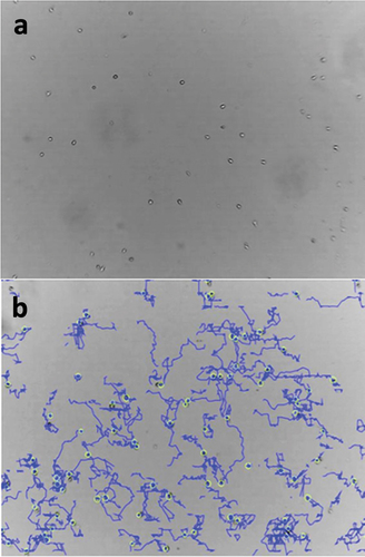 Figure 1. Representative snapshot of control NK-92 cells without (a) and with (b) tracking mode as seen via CytoSMARTTM live cell imaging technology.
