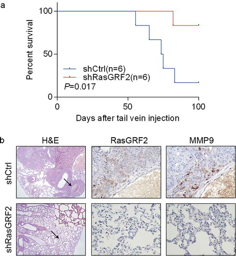 Figure 4. RasGRF2 contributes to CRC cell migration in vivo. (a) Kaplan–Meier survival curves of mice injected with control and RasGRF2-silenced HCT116 cells. n, number of mice use in each group. (b) Tissue sections from tumor-bearing lung of mice inoculated with control and RasGRF2 knockdown cells were stained with hematoxylin and eosin (H&E). IHC staining using antibodies against RasGRF2 and MMP9.