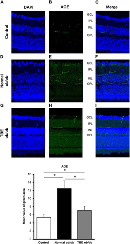 Figure 2 Effect of TBE on glycation. A comparison of AGE immunofluorescence (green) when the control mice (A–C) and ob/ob mice were fed with a normal diet (D–F) or diet containing TBE (G–I). AGE expression was observed along the vascular plexus of the retina; in the diabetic retina of mice fed with a normal diet, the expression was significantly increased compared with the control mice (E and F). However, in the diabetic retina of TBE ob/ob mice, AGE expression was significantly decreased compared with the normal ob/ob mice (H and I). Values are expressed as means ± SD. *P < 0.05. Nuclei were counter-stained with DAPI (blue).