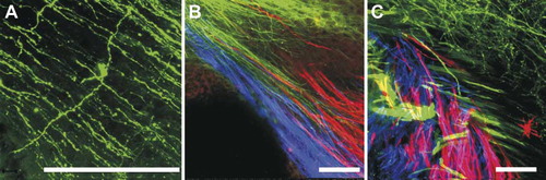 Figure 6: Three-color imaging with NV Jade, Red, and Maroon allows excellent resolution of thin fibers and discrete nerve tracts in near-adult murine brain. Nerve tracts projecting from one region of mature brain to another were labeled with NV Jade (green pseudocolor), NV Red (red pseudocolor) or NV Maroon (blue pseudocolor) and imaged by confocal microscopy after 5 days of diffusion at 37°C. Bar indicates 100 μm in all images. Panel A: Despite increased green autofluorescence due to myelinization of near-adult brain, NV Jade can be used in 18-day-old cerebella to label not only parallel fibers (green lines crossing from top left to bottom right) but also individual cells (stellar neuron in the center of A) at distances of up to 5 mm away from the injection site. (Representative image selected from 12 replicate specimens.) Panels B and C: After labeling in the pontine nuclei, cerebellar cortex and restiform body of the cerebellum with NV Jade, NV Red or NV Maroon, respectively, discrete fibers are consistently labeled and readily visualized near the deep cerebellar nuclei of P18 animals without bleed through and at distances of up to 1 cm away from the injection site over 50 animals. The same type of labeling was used on two replicate specimens, which were cut slightly differently to show fiber bundles running in parallel (B) or crossing one another (C).