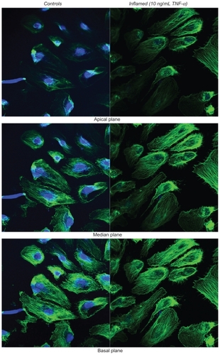 Figure 2 Apparent elastic modulus for three different endothelial cell lines. Bar chart presenting the apparent elastic modulus E for HUVEC, HCAEC, and HPMEC under unstimulated (control) and stimulated (20 h with 10 ng/mL TNF-α) conditions.(Find = 0.5 nN; vind = 0.25 μm/s; *P < 0.05; number of cells n = 3; repetitions per cell N > 30).